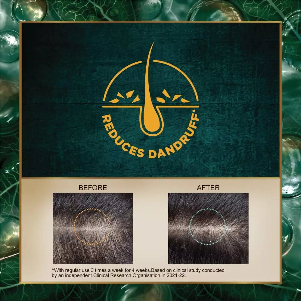 Indulekha Bringha Hair Cleanser Shampoo – 200ml Indulekha