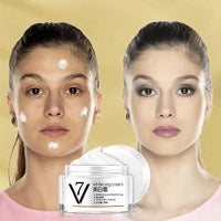 Whitening Cream